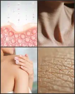 vitamin-A-skin